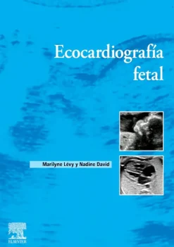 Ciencias De La Salud*Elsevier Ecocardiografía fetal