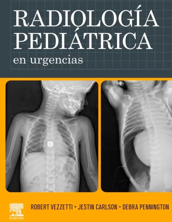 Ciencias De La Salud*Elsevier Radiología pediátrica en urgencias
